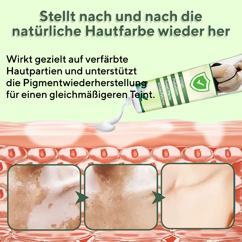 Fivfivgo® Vitiligo-Behandlungssalbe