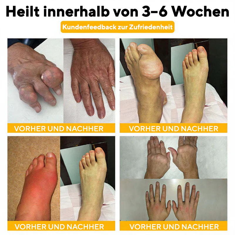 NovaRX® Bienengift SchmerzlinderndesGelenk-Beruhigungsspray