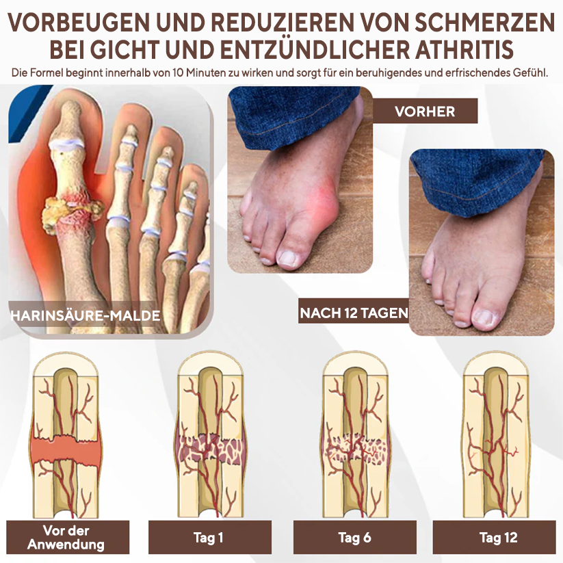 NovaRX® MagniBee Gelenkunterstützungs Formel-Spray