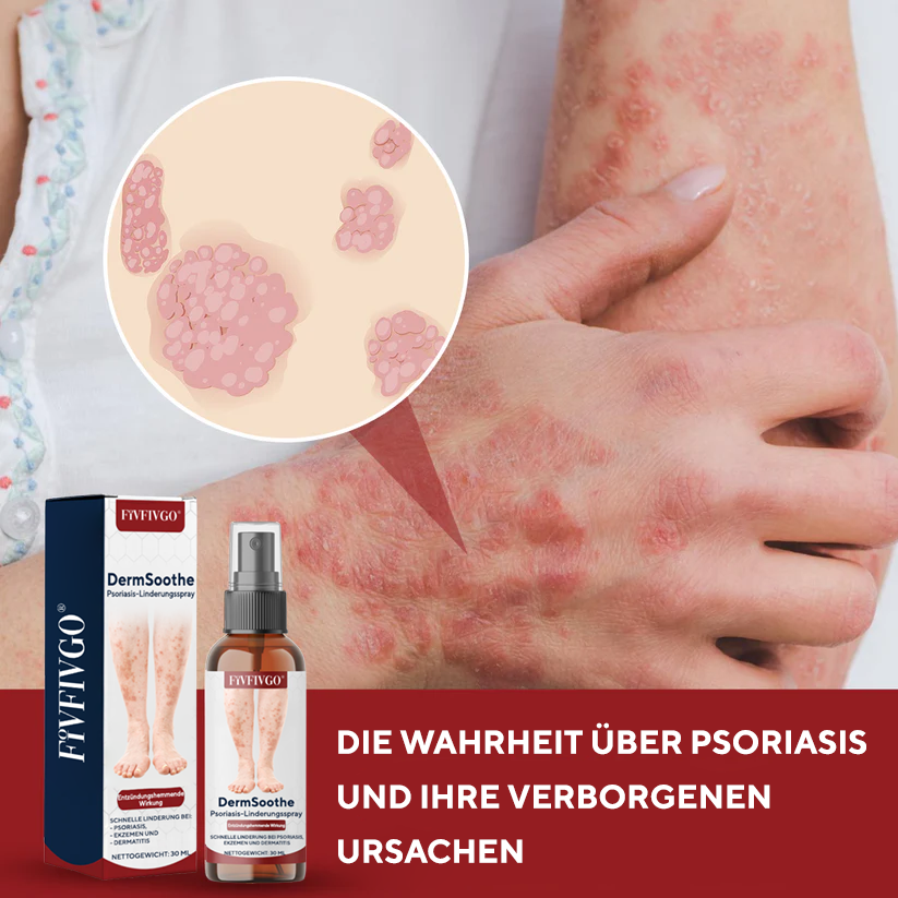 Fivfivgo® DermSoothe Psoriasis-Linderungsspray