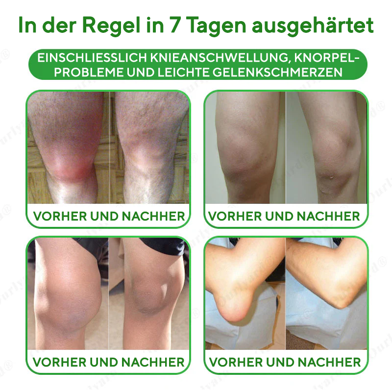 NovaRX® Fortschrittliches Magnesium- und Emuöl-Massagegel zur Schmerzlinderung