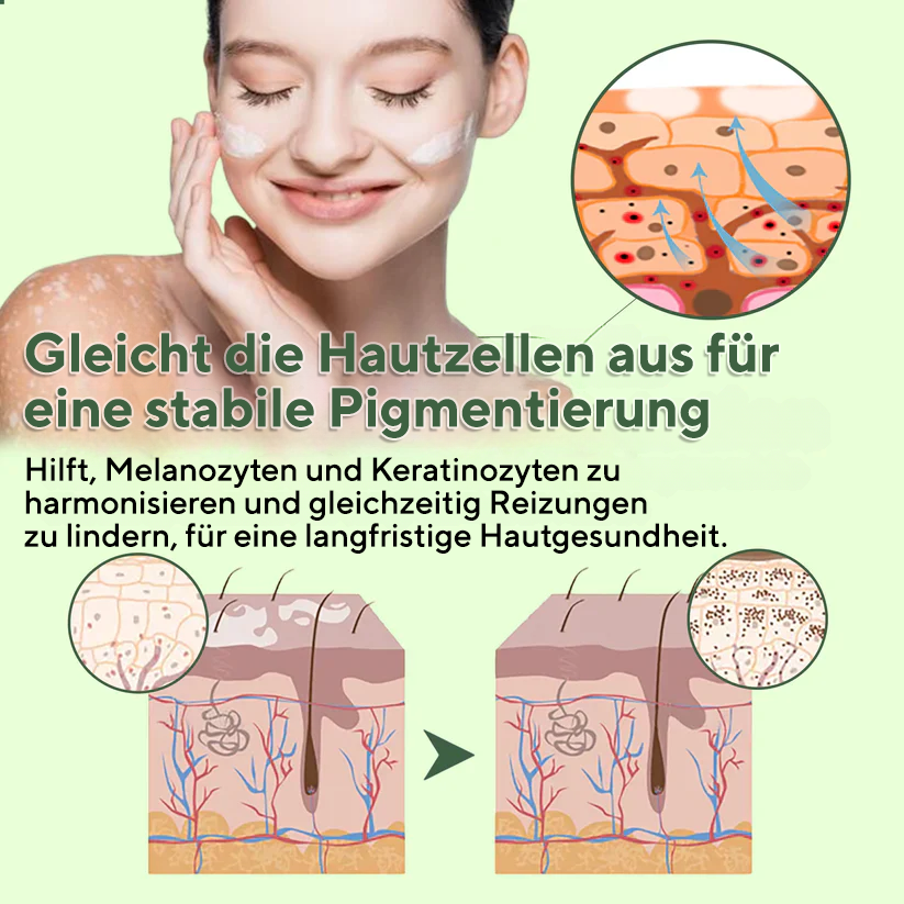 Fivfivgo® Vitiligo-Behandlungssalbe
