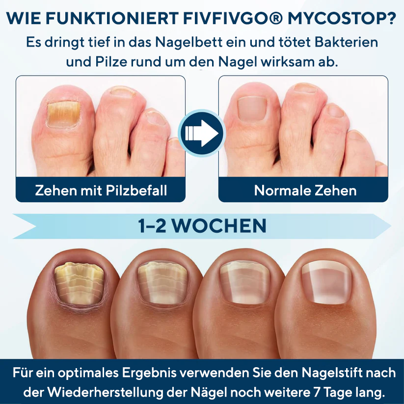 Fivfivgo® MycoStop Nagel-Reparatur-Serum-Stift