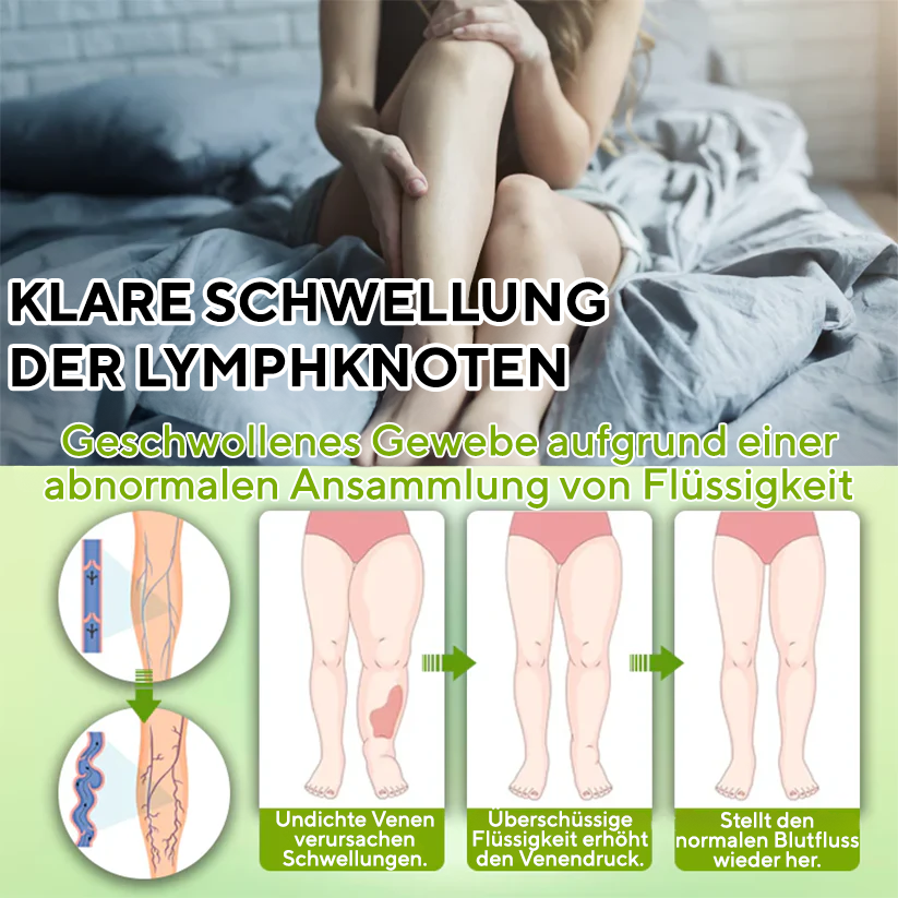 NovaRX® FluidQuit Ödem-Unterstützungsspray