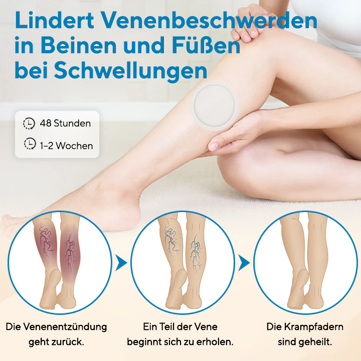 Fivfivgo® VeinEase Mikronadel-Pflaster (Erweiterte Durchblutungsunterstützung bei Krampfadern und Besenreisern)