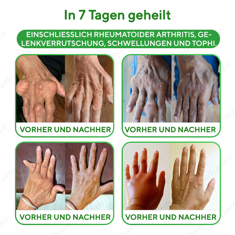 NovaRX® Fortschrittliches Magnesium- und Emuöl-Massagegel zur Schmerzlinderung