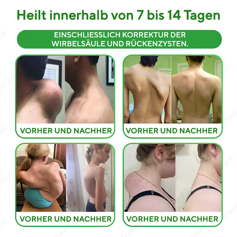 NovaRX® Fortschrittliches Magnesium- und Emuöl-Massagegel zur Schmerzlinderung