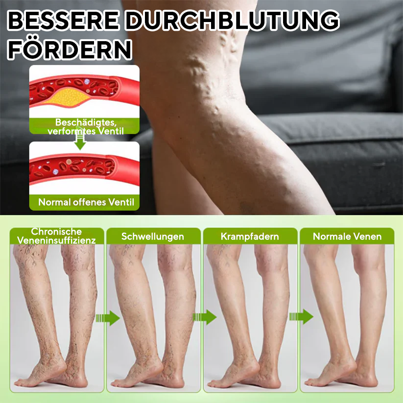 NovaRX® FluidQuit Ödem-Unterstützungsspray