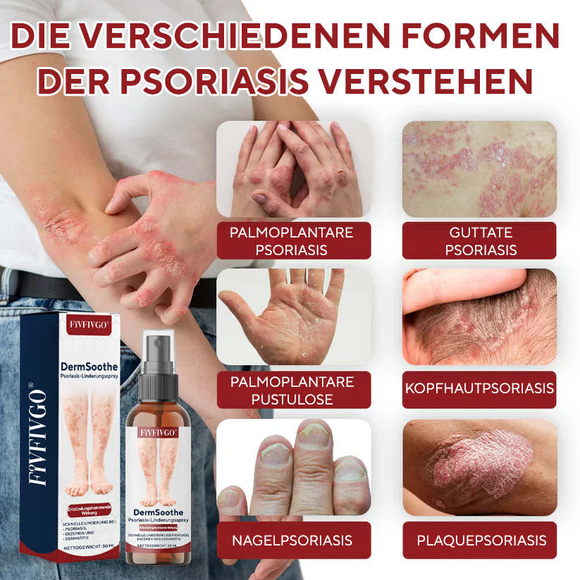 Fivfivgo® DermSoothe Psoriasis-Linderungsspray