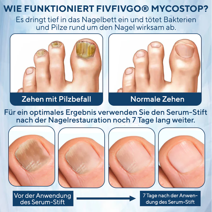 Fivfivgo® MycoStop Nagel-Reparatur-Serum-Stift
