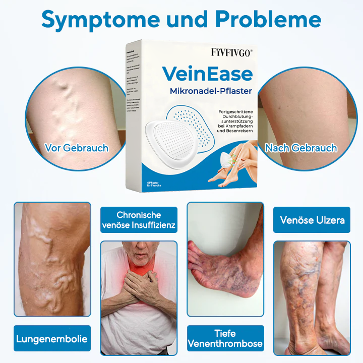 Fivfivgo® VeinEase Mikronadel-Pflaster (Erweiterte Durchblutungsunterstützung bei Krampfadern und Besenreisern)