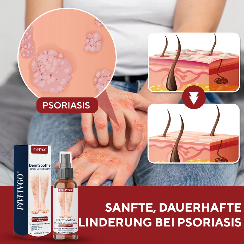 Fivfivgo® DermSoothe Psoriasis-Linderungsspray
