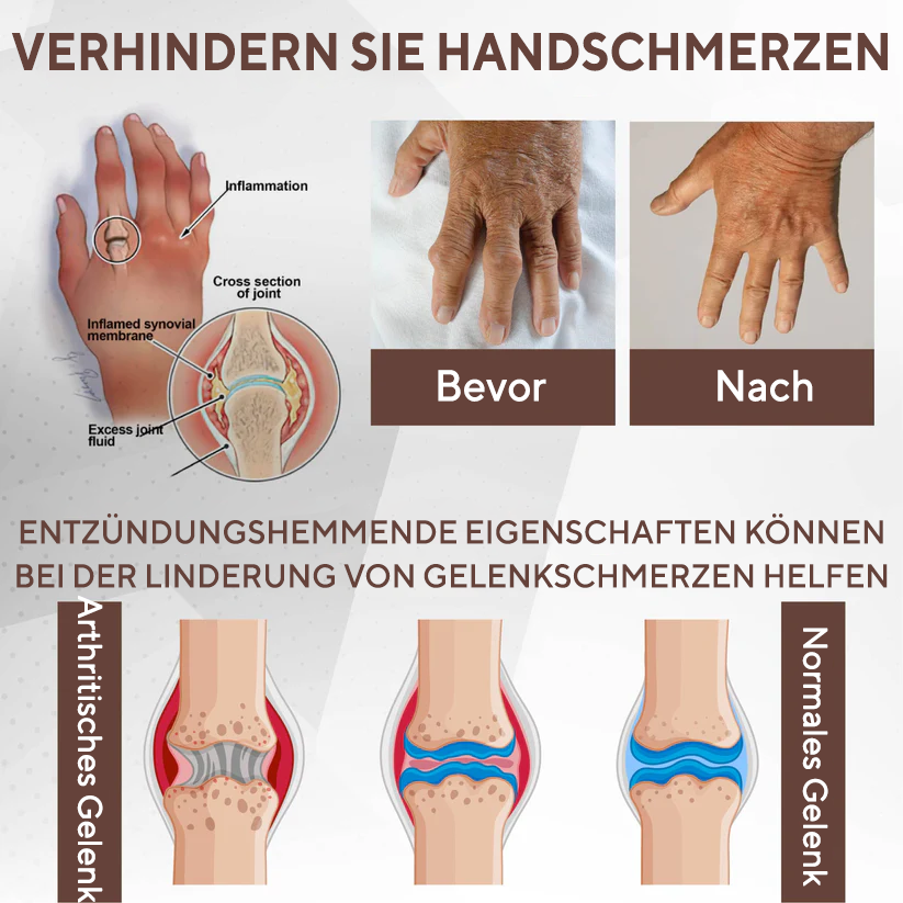 NovaRX® MagniBee Gelenkunterstützungs Formel-Spray