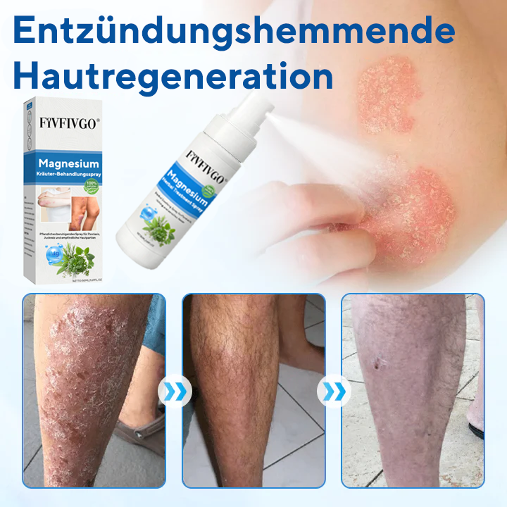 Fivfivgo® Magnesium Kräuter-Behandlungsspray