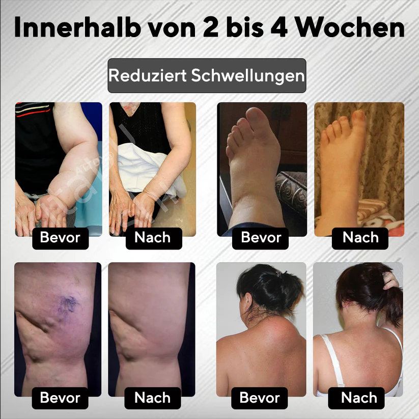 Bikenda® RedHeat EMS Ödem-Drainage-Beinmassagegerät
