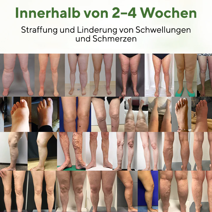 NovaRX® FluidEase Beintherapie-Ödemcreme