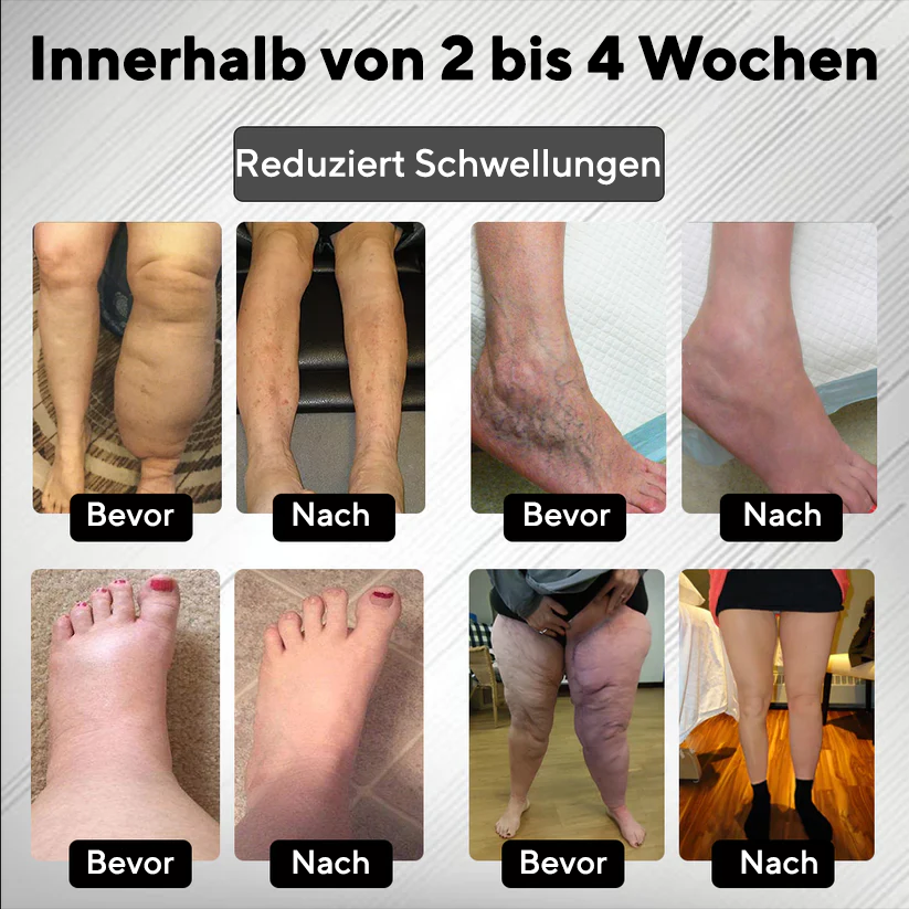 Bikenda® RedHeat EMS Ödem-Drainage-Beinmassagegerät
