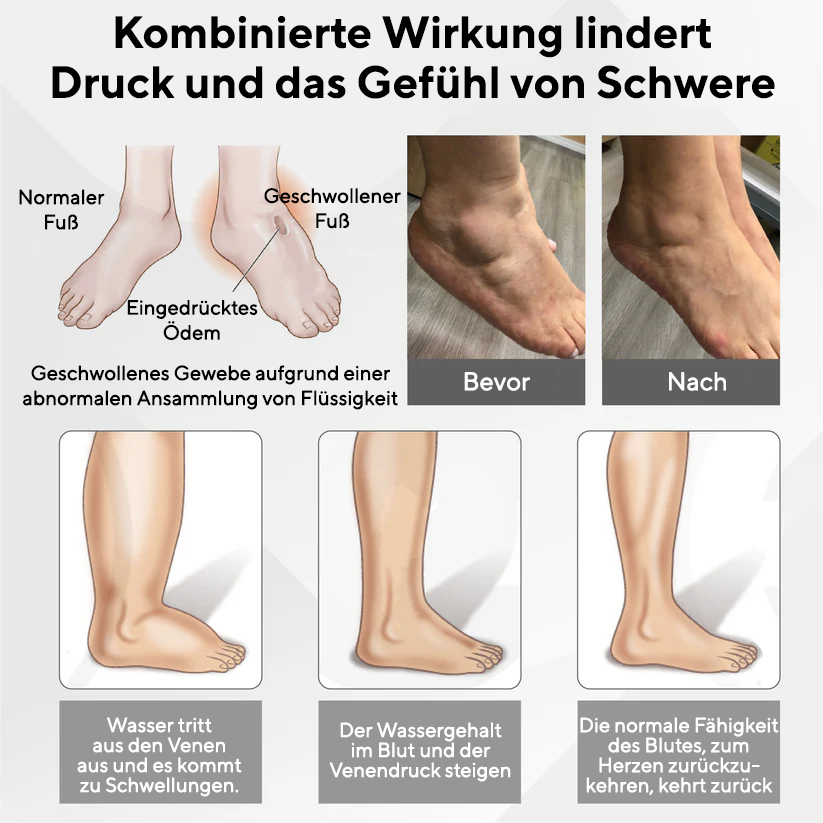 Bikenda® RedHeat EMS Ödem-Drainage-Beinmassagegerät