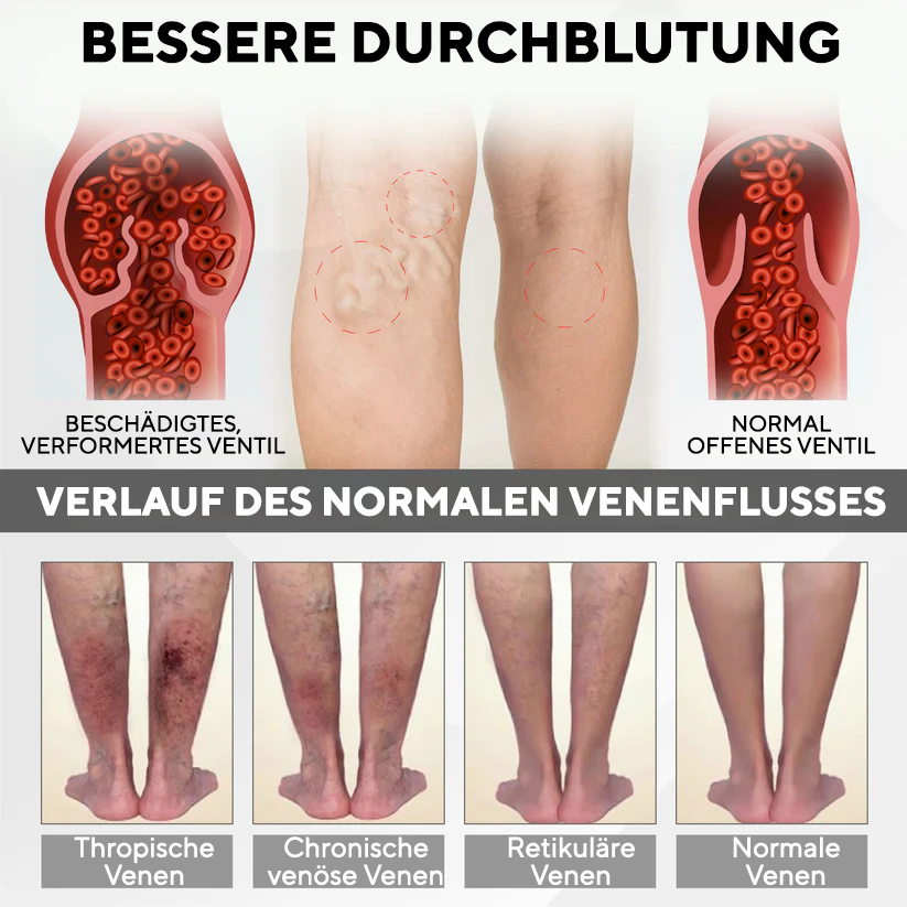 Bikenda® RedHeat EMS Ödem-Drainage-Beinmassagegerät
