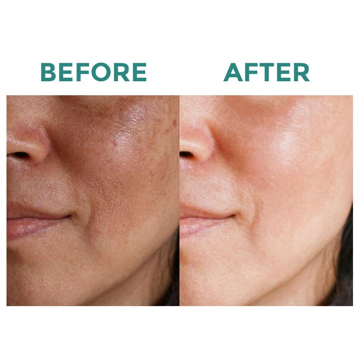 Savon éclaircissant au lait au collagène Fivfivgo™