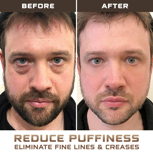 Fivfivgo™ Men Expert Pro Hydra Energetic Eye Roller