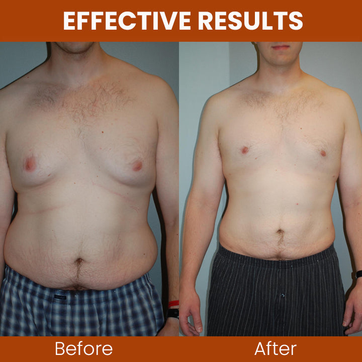 Fivfivgo™ Gynecomastia Chest Tightening Spray