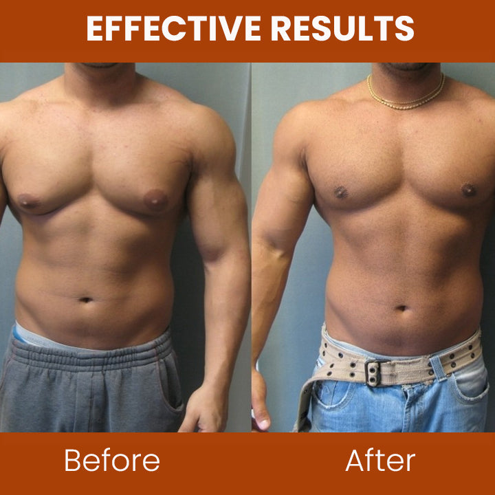 Fivfivgo™ Gynecomastia Chest Tightening Spray