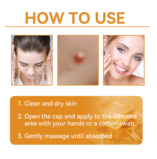Fivfivgo™ Bee Venom Warts & Blemish Remover