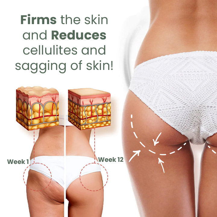 Fivfivgo™ Wormwood CelluliteBeGone Skin Tighten Cream