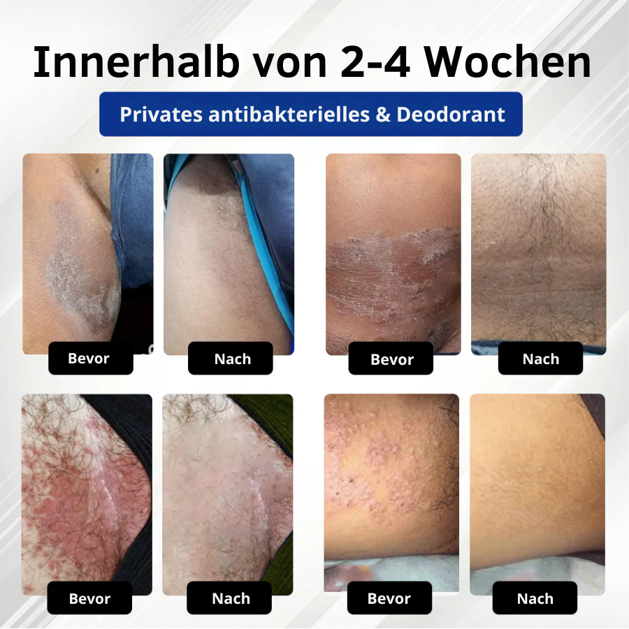 Fivfivgo® LicorRelief Mann Genital Antimykotisch Creme