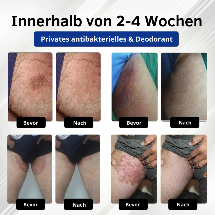 Fivfivgo® LicorRelief Mann Genital Antimykotisch Creme