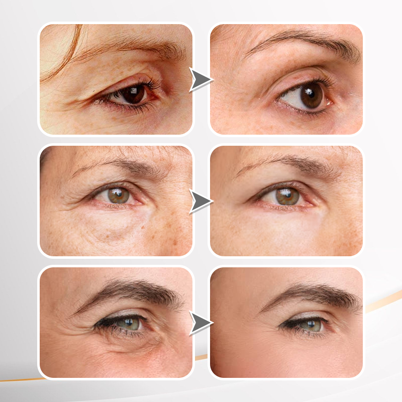 Fivfivgo™ YouthfulLift Augenstraffende Creme