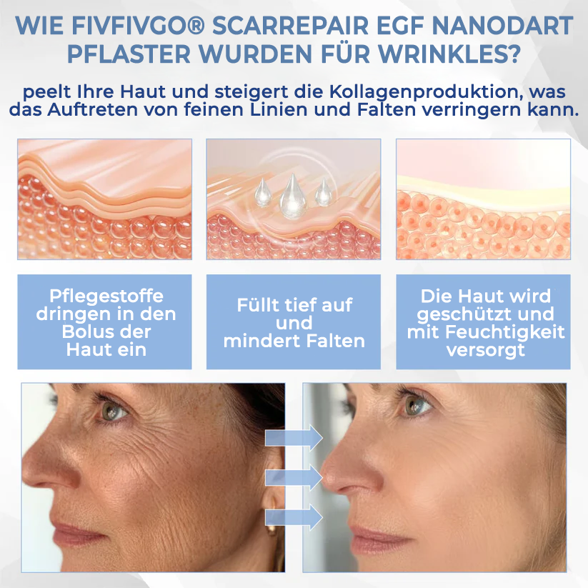 Fivfivgo® ScarRepair EGF-Nanodartpflaster