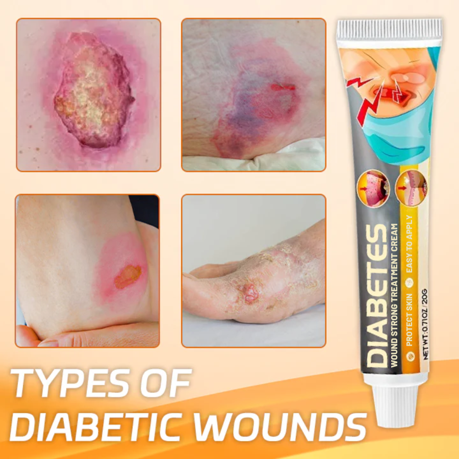 Fivfivgo™ Diabetes Wound Strong Treatment Cream