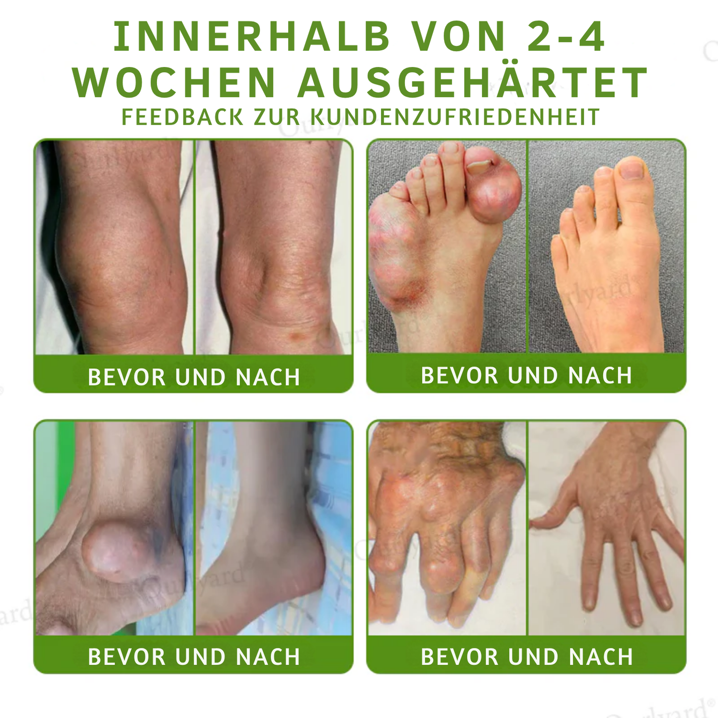 NovaRX® Magnesium & Pfefferminze Arthritis Schmerzlinderung und Knochenheilungscreme