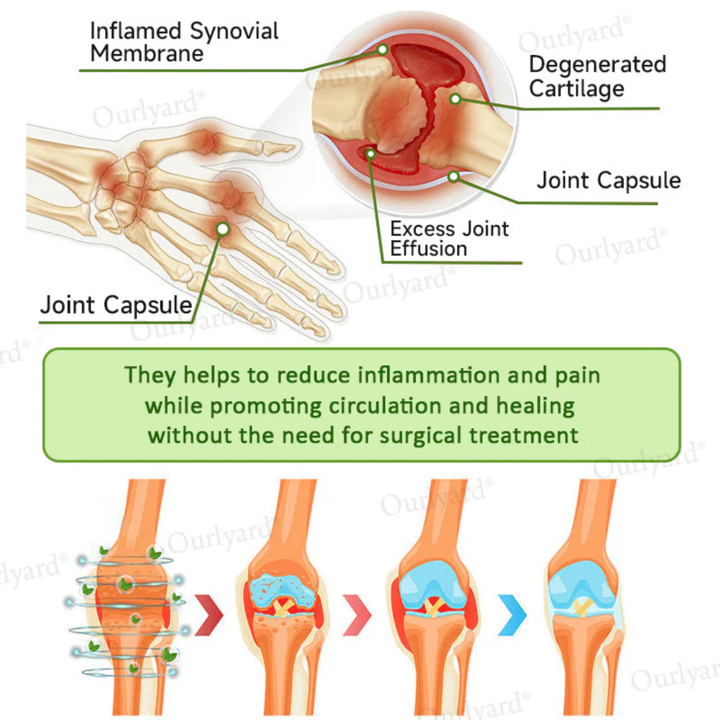 NovaRX® Magnesium & Peppermint Arthritis Pain Relief and Bone Healing Cream