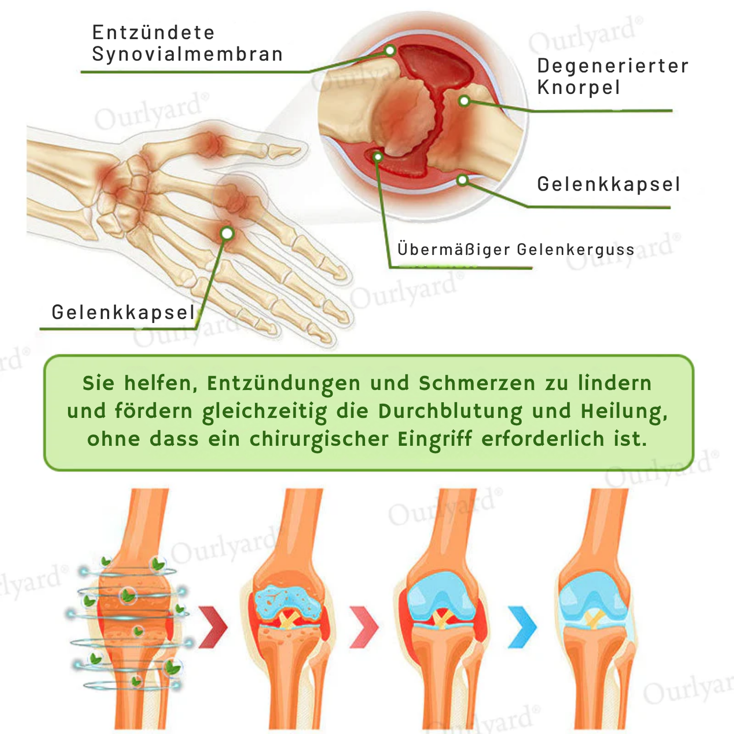 NovaRX® Magnesium & Pfefferminze Arthritis Schmerzlinderung und Knochenheilungscreme