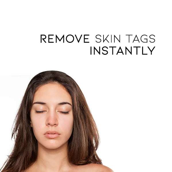 Fivfivgo™ Bee Venom Mole & Wart Treatment Cream