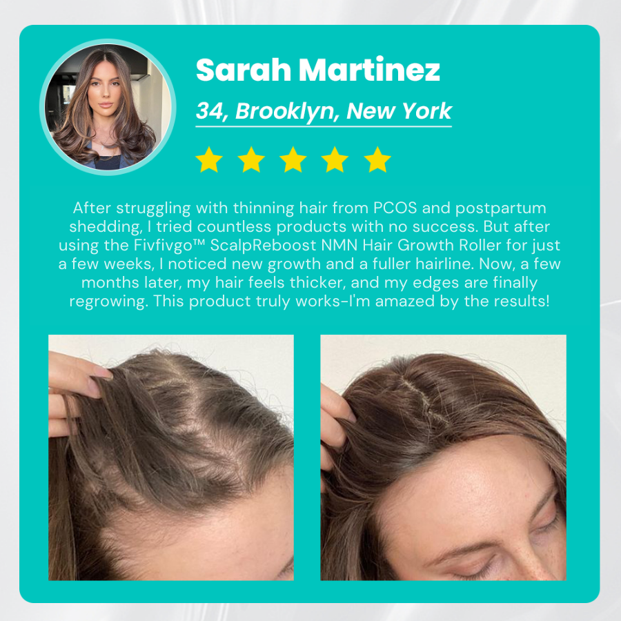 Fivfivgo™ ScalpReboost NMN Haarwuchs Roller