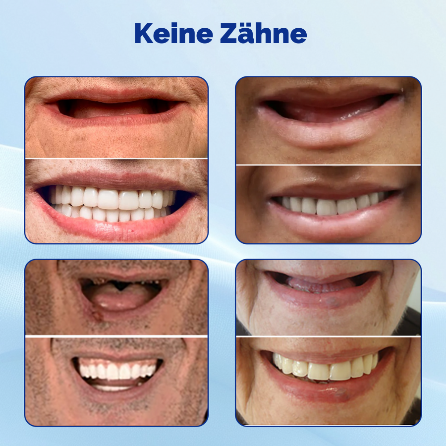 Bikenda® Fortgeschrittenes individuelles Vollprothesenset