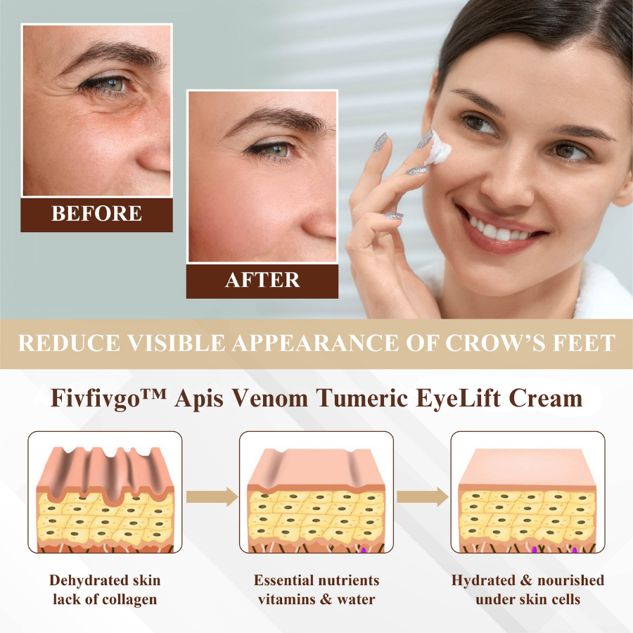 Fivfivgo™ ApisVenom Tumeric EyeLift Cream
