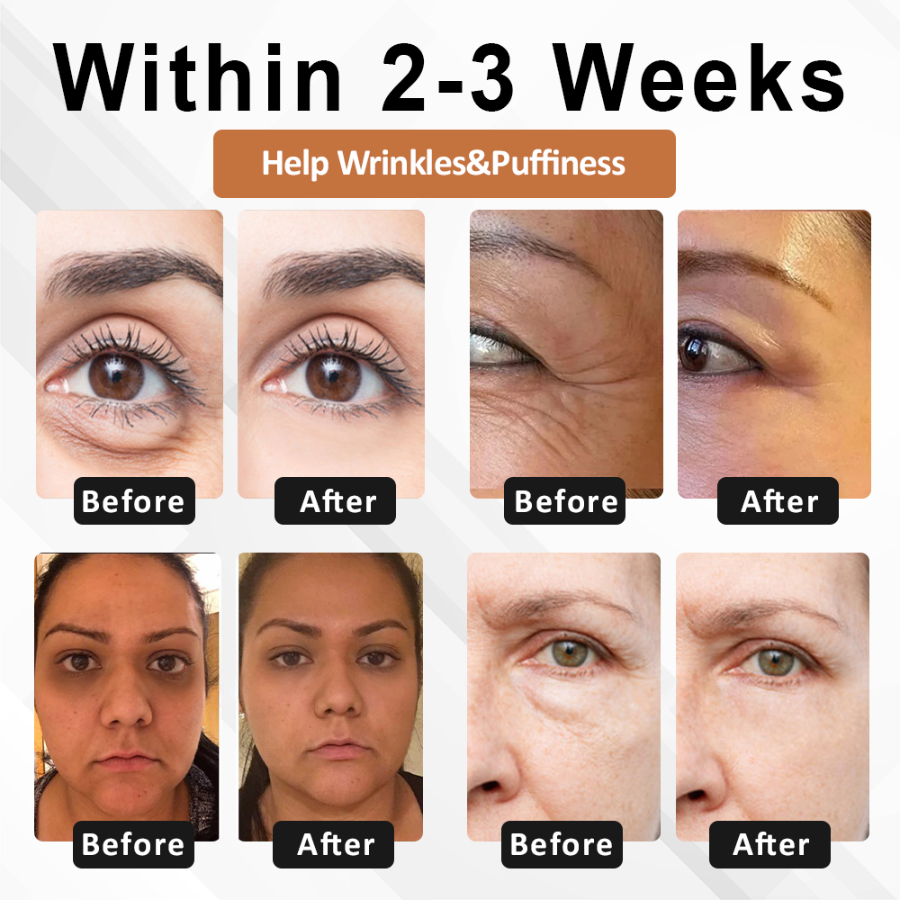 Fivfivgo™ ApisVenom Tumeric EyeLift Cream