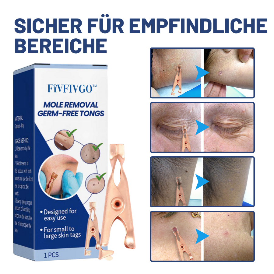 Fivfivgo™ Maulwurfsentfernung Keimfreie Zange