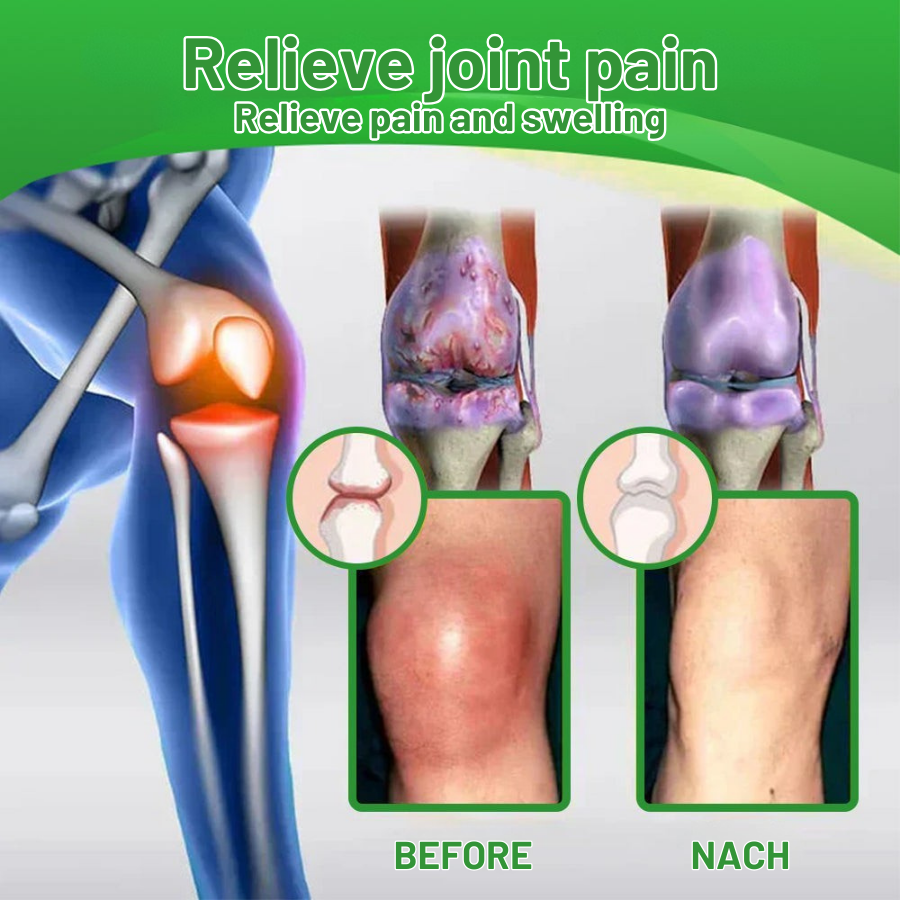 Fivfivgo™ Lidocaine 5-Minute Pain Relief Healing Spray