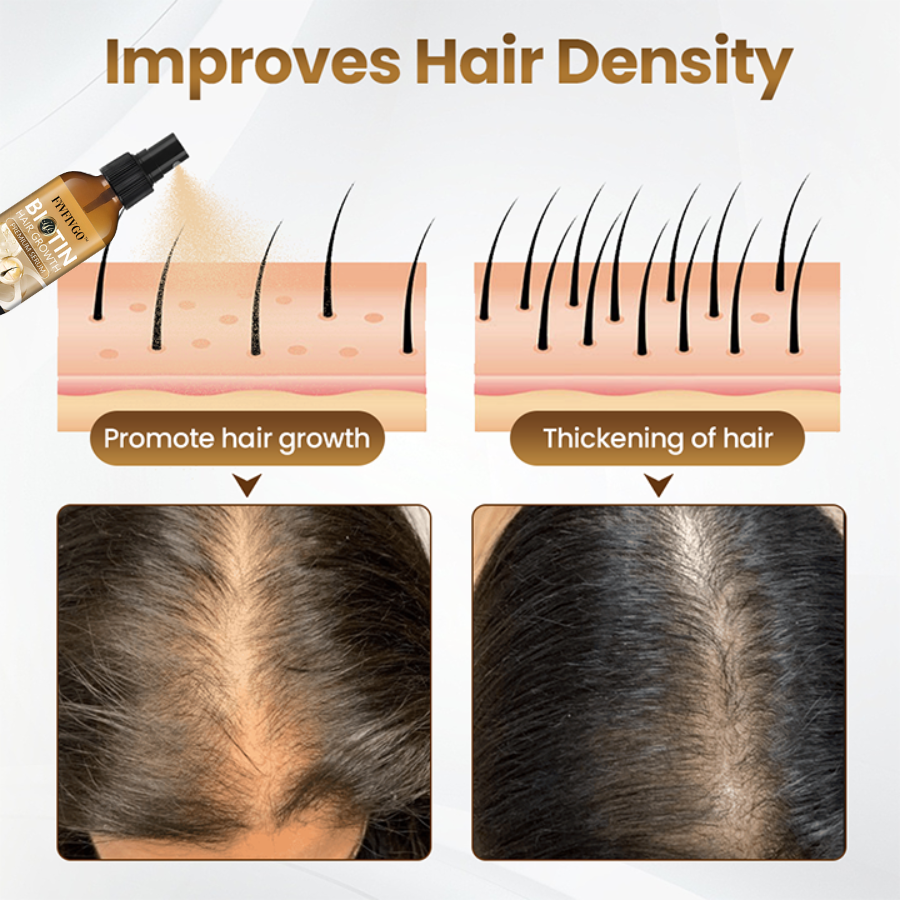 Fivfivgo™ Biotin HairRevive Growth Premium Serum