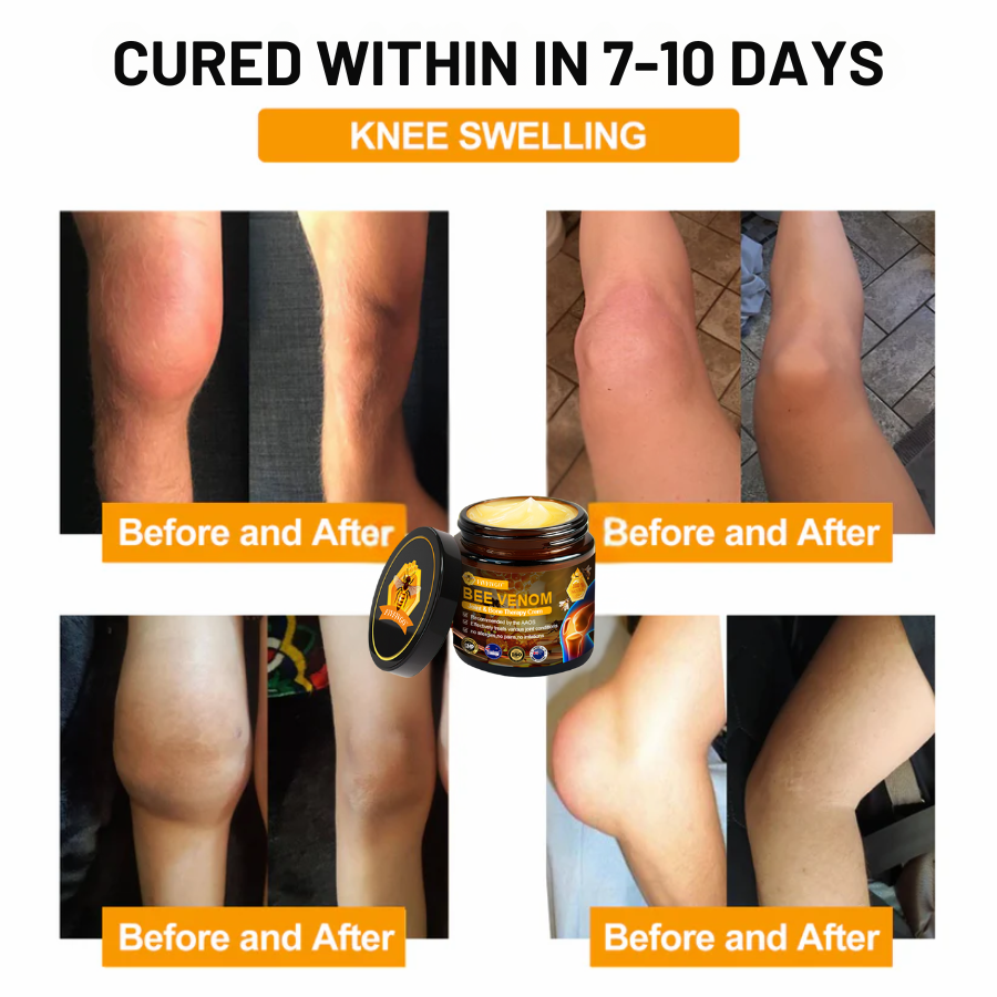 Fivfivgo™ Bee Venom Joint & Bone Therapy Cream