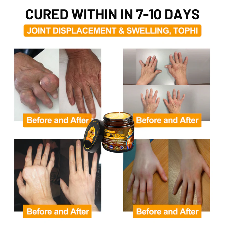 Fivfivgo™ Bee Venom Joint & Bone Therapy Cream