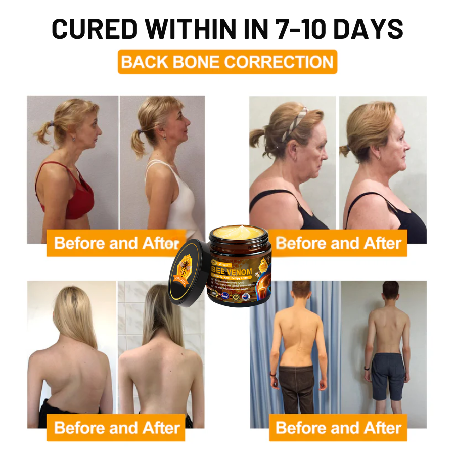 Fivfivgo™ Bee Venom Joint & Bone Therapy Cream