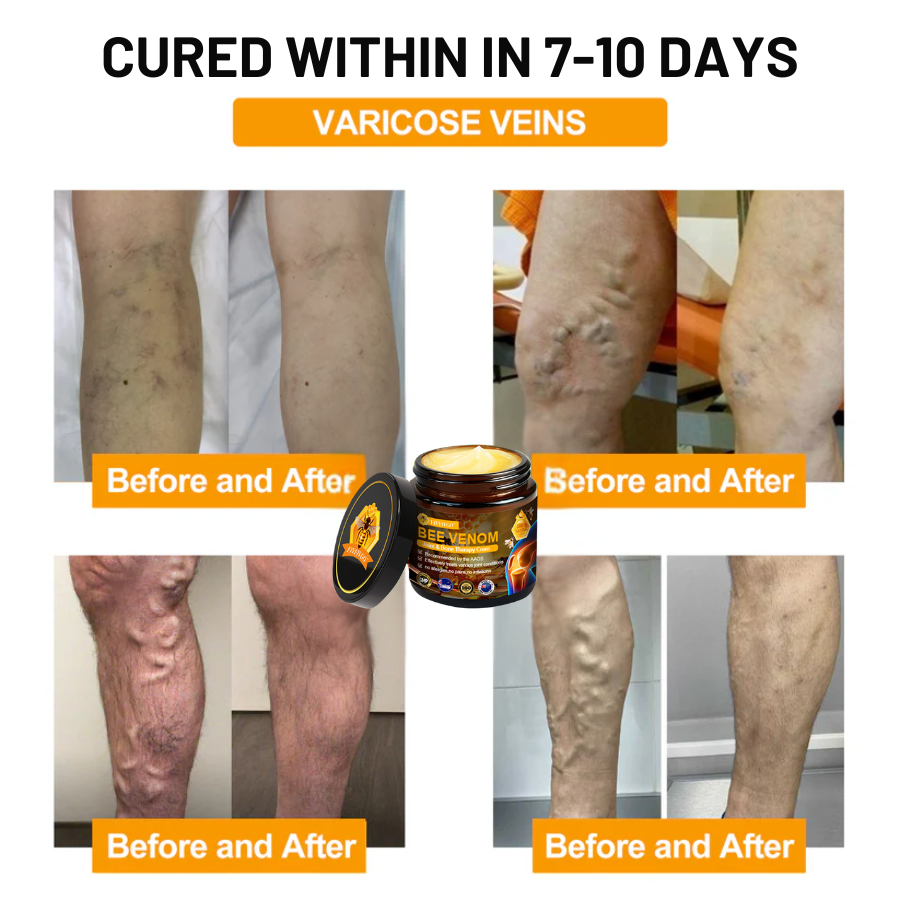 Fivfivgo™ Bee Venom Joint & Bone Therapy Cream