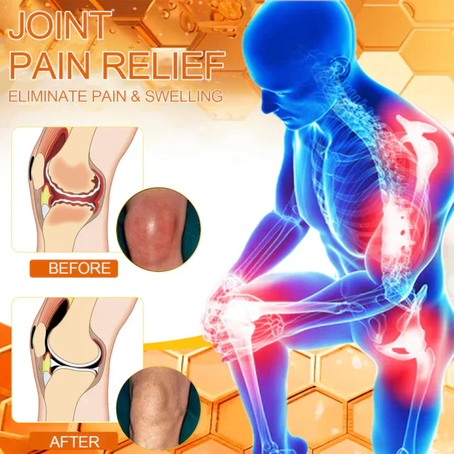 Fivfivgo™ Bee Venom Joint & Bone Therapy Cream